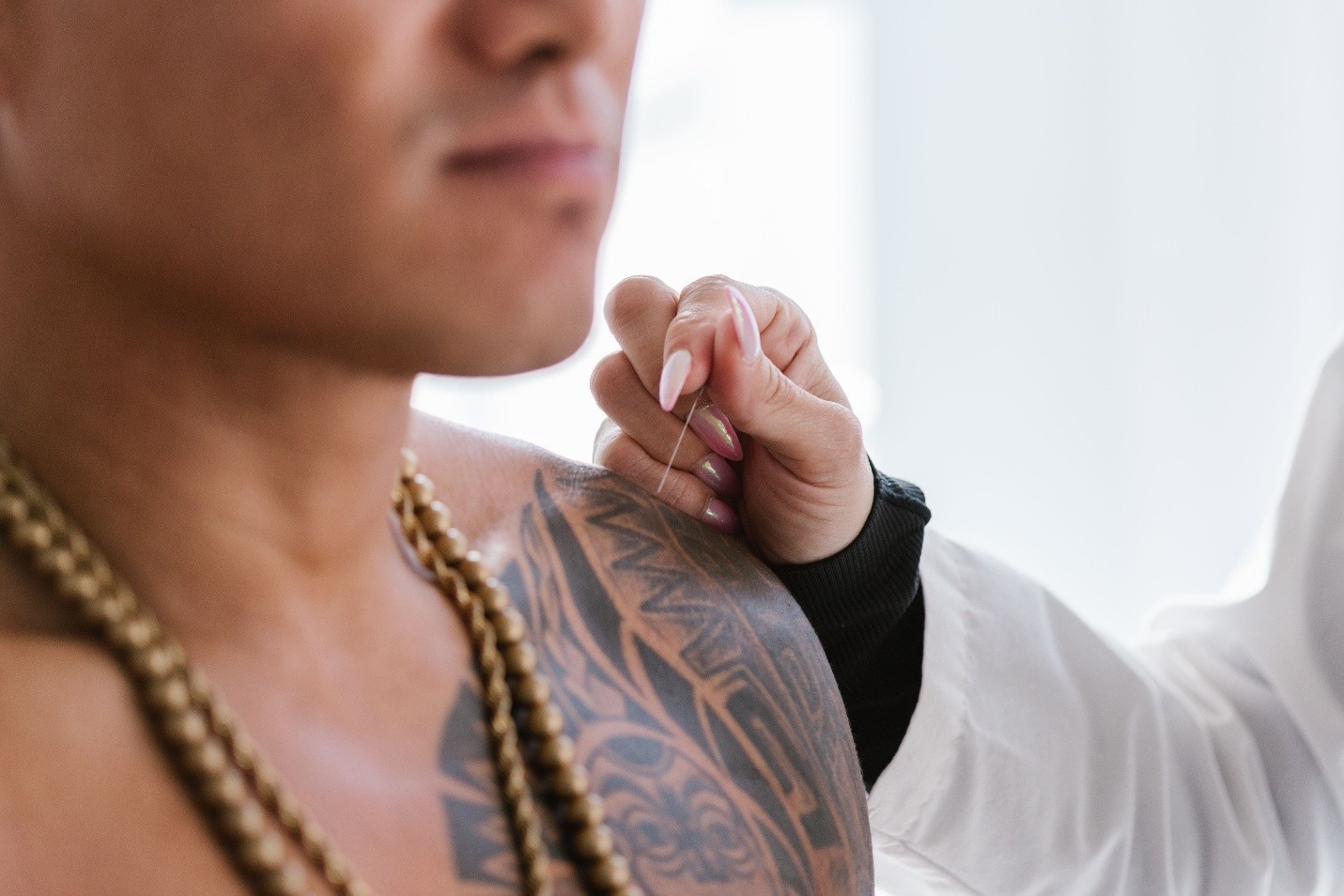 Motor Point Acupuncture for Pain and Recovery