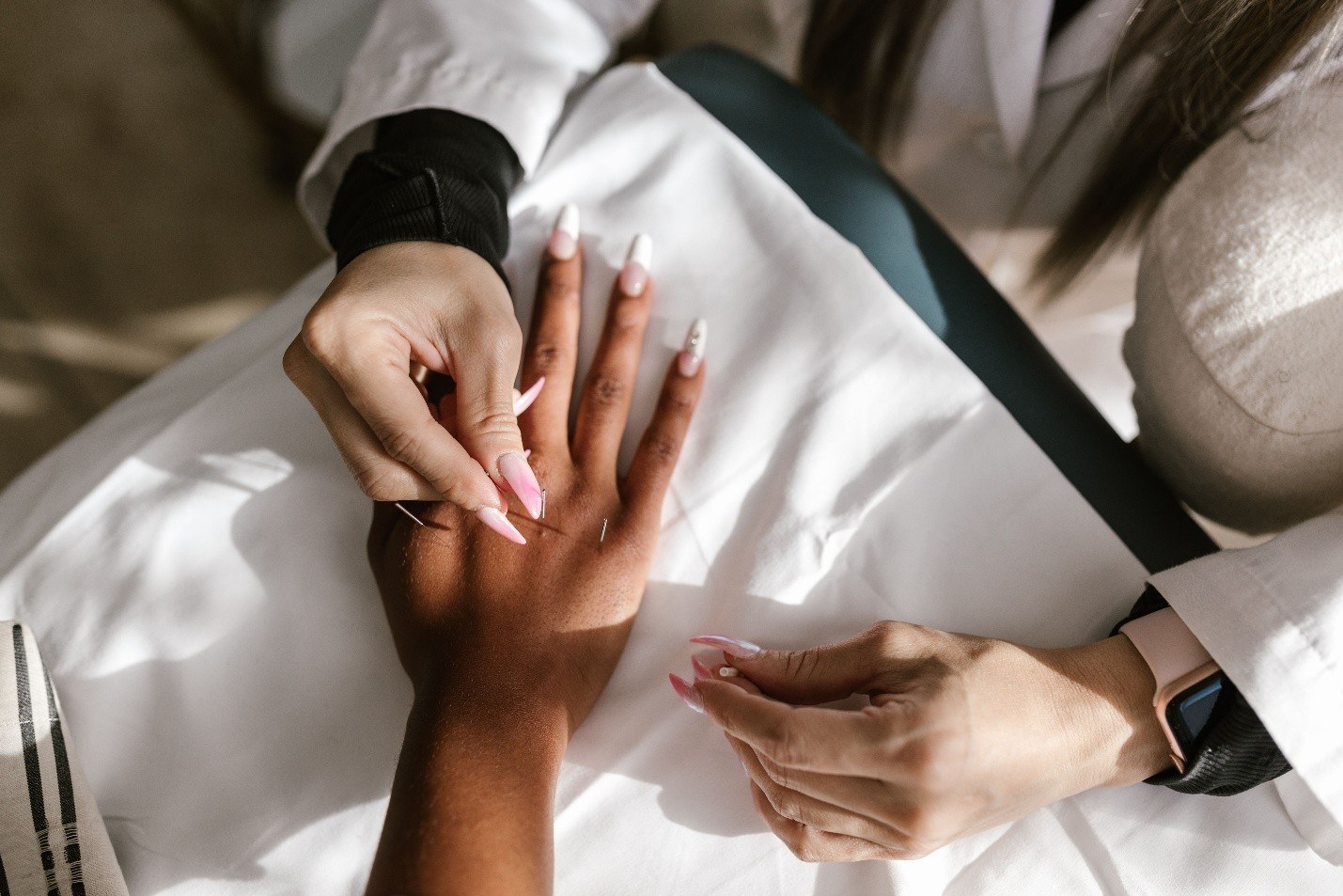 Why Acupuncture Isn't About the Spot That Hurts