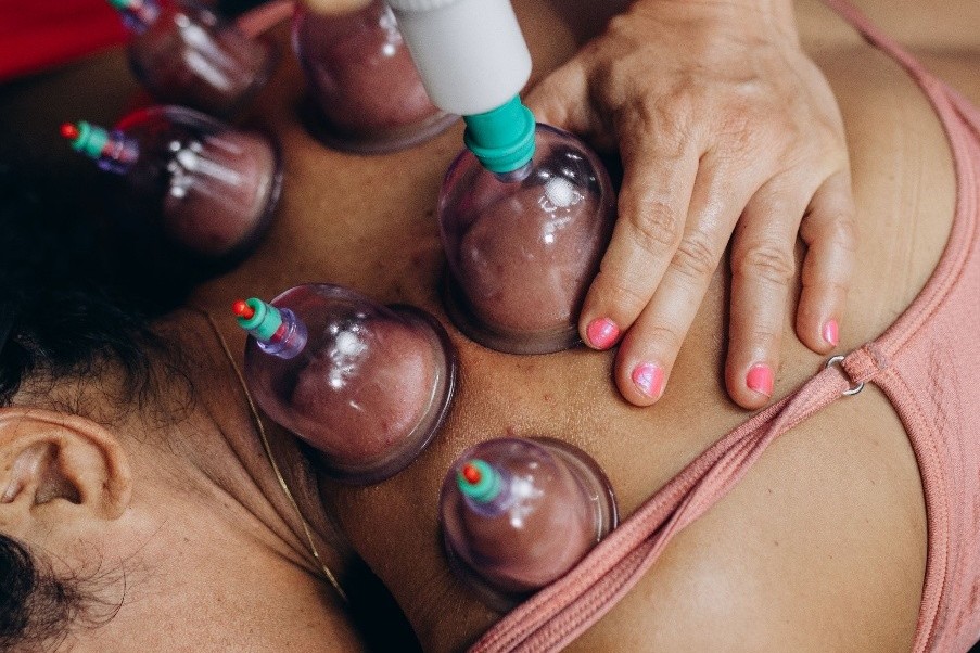 What is Cupping Therapy?
