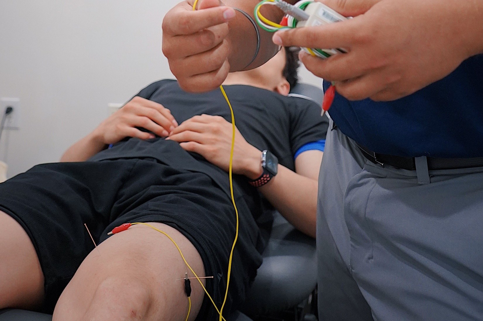 Electroacupuncture: Precision, Stimulation & Healing